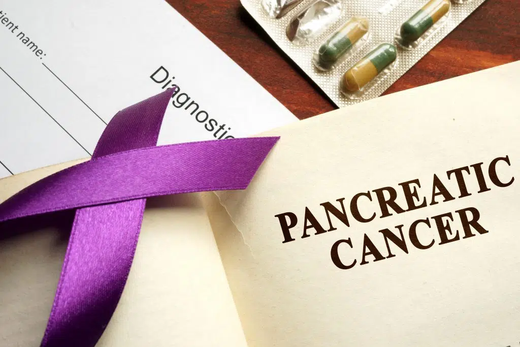 New PARP Inhibitor Approval for Pancreatic Cancer